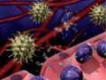 FM-12 Immunologic Diseases