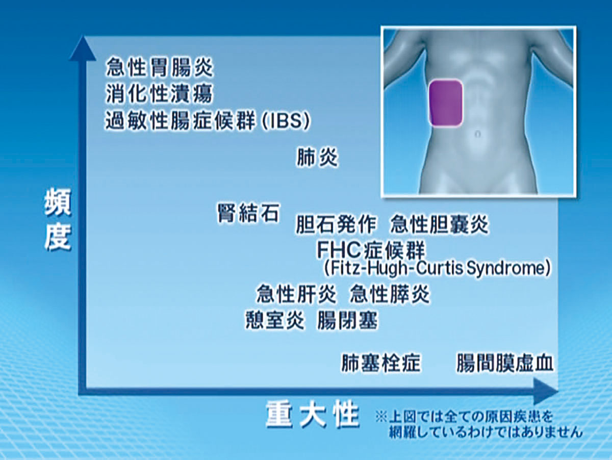ePFJ-03 腹痛