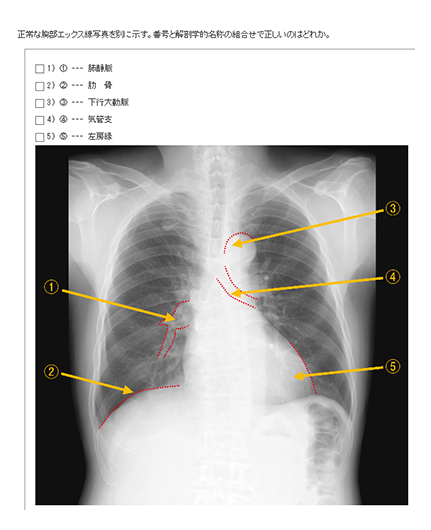 出題例
